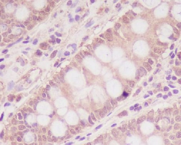 IGF2R Antibody in Immunohistochemistry (Paraffin) (IHC (P))