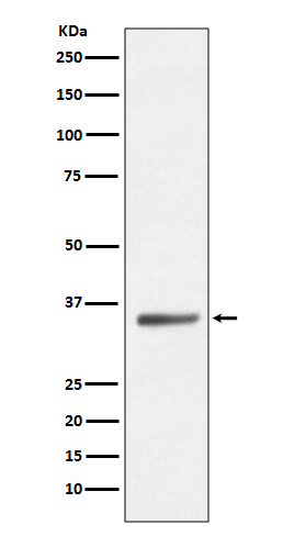SIRT5 Antibody in Western Blot (WB)