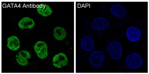 GATA4 Antibody in Immunocytochemistry (ICC/IF)