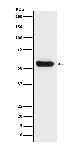 LPL Antibody in Western Blot (WB)