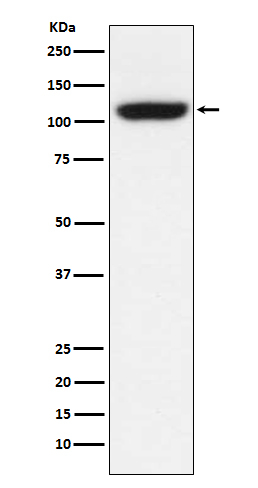 TRPM8 Antibody in Western Blot (WB)
