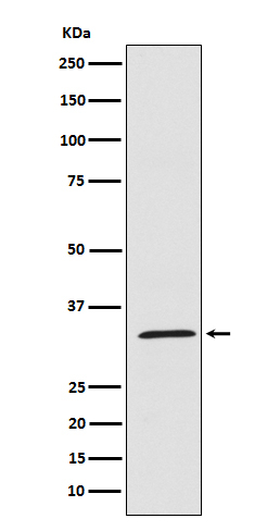 UCP1/UCP3 Antibody in Western Blot (WB)
