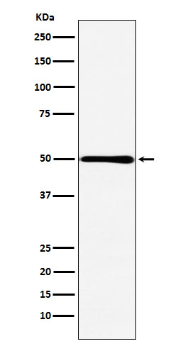HMGCS2 Antibody in Western Blot (WB)