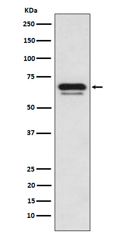 GATAD2A Antibody in Western Blot (WB)