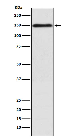 COL11A1 Antibody in Western Blot (WB)
