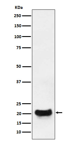 DCTN5 Antibody in Western Blot (WB)