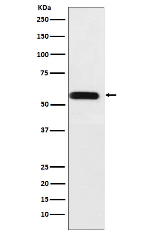 ANGPTL3 Antibody in Western Blot (WB)