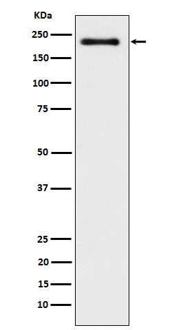 WRN Antibody in Western Blot (WB)