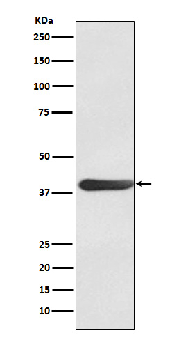 Fra1 Antibody in Western Blot (WB)