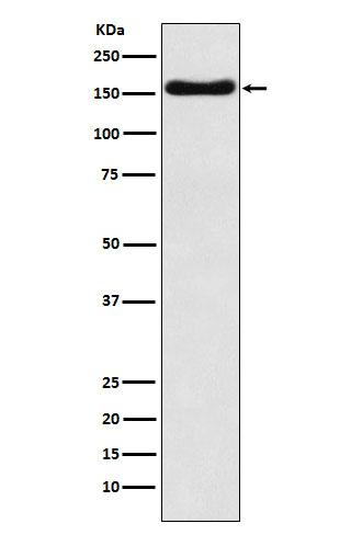 ATP7B Antibody in Western Blot (WB)