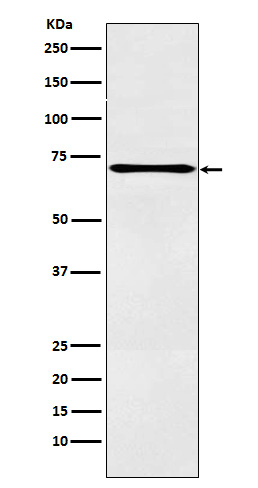 ALOX12 Antibody in Western Blot (WB)