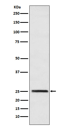 TPI1 Antibody in Western Blot (WB)