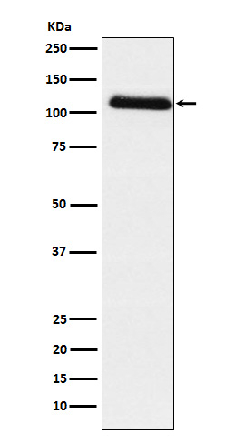 Fibrinogen alpha chain Antibody in Western Blot (WB)