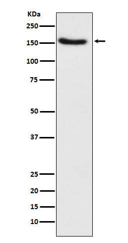 TSC1 Antibody in Western Blot (WB)