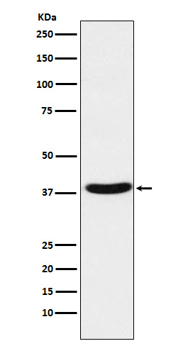 MT-ND1 Antibody in Western Blot (WB)