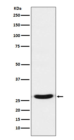 TCF21 Antibody in Western Blot (WB)