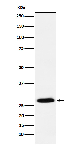 GSC Antibody in Western Blot (WB)
