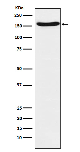 FANCA Antibody in Western Blot (WB)