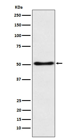 SFRP4 Antibody in Western Blot (WB)