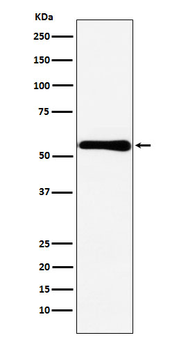 CBS Antibody in Western Blot (WB)