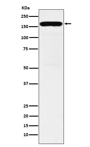 DIAPH1 Antibody in Western Blot (WB)