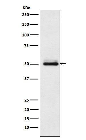 CYP2C9 Antibody in Western Blot (WB)
