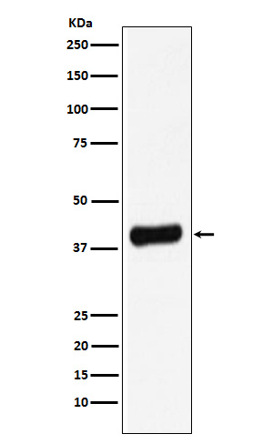 Galectin 8 Antibody in Western Blot (WB)