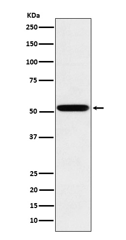 Human IgG2 Antibody in Western Blot (WB)