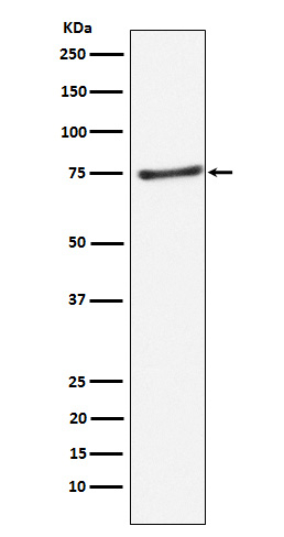 PIAS1 Antibody in Western Blot (WB)
