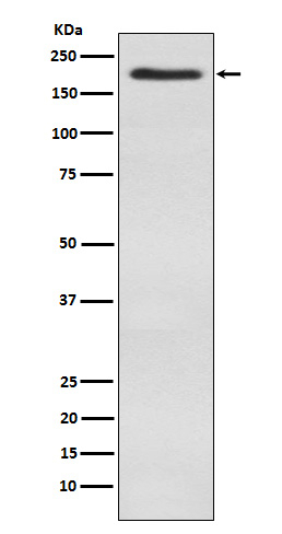 BAZ1B Antibody in Western Blot (WB)