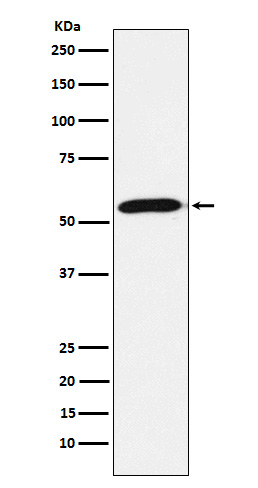FBXO5 Antibody in Western Blot (WB)