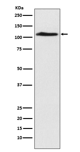CHD1L Antibody in Western Blot (WB)