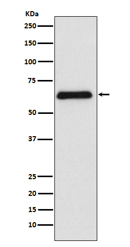 PARP2 Antibody in Western Blot (WB)