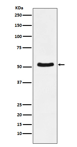 DDX6 Antibody in Western Blot (WB)