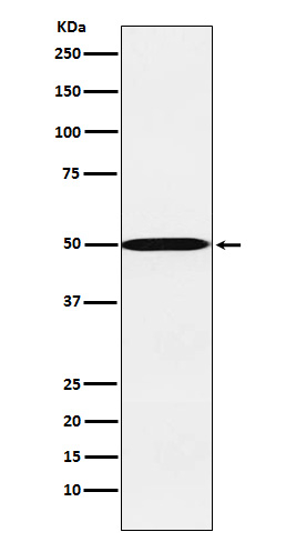 CYP26A1 Antibody in Western Blot (WB)