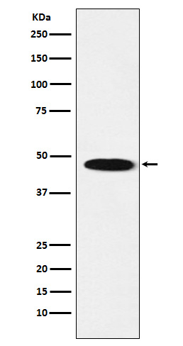 GABRB1 Antibody in Western Blot (WB)