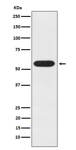 UAP1 Antibody in Western Blot (WB)