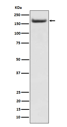 IRS2 Antibody in Western Blot (WB)