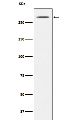 Thyroglobulin Antibody in Western Blot (WB)