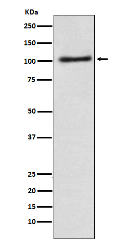 alpha Adaptin Antibody in Western Blot (WB)