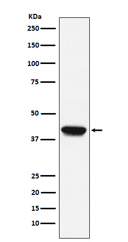 Biglycan Antibody in Western Blot (WB)