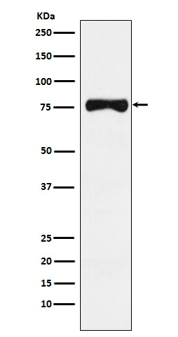 TYRP1 Antibody in Western Blot (WB)