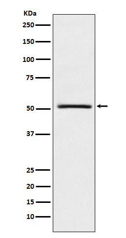 NR0B1 Antibody in Western Blot (WB)