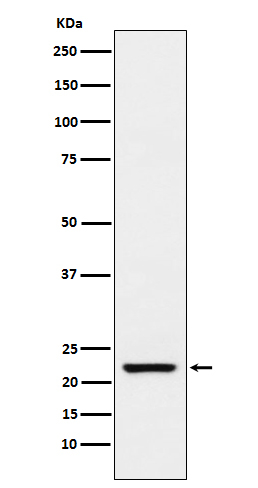 TAGLN Antibody in Western Blot (WB)