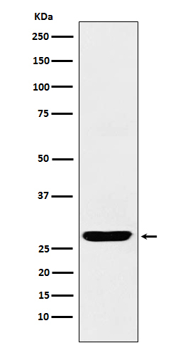 SCGN Antibody in Western Blot (WB)