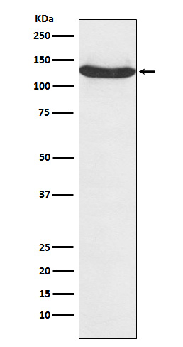 hnRNP U Antibody in Western Blot (WB)