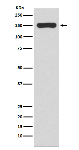 RNA polymerase beta Antibody in Western Blot (WB)