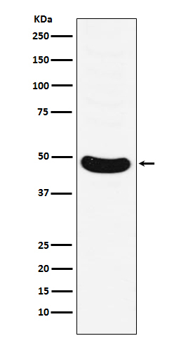 HB9 Antibody in Western Blot (WB)