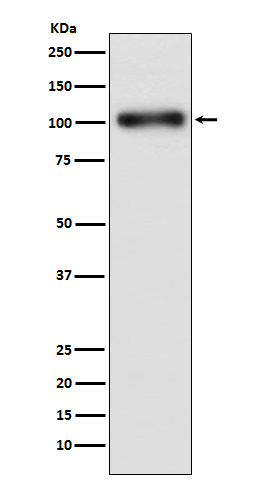 GABBR1 Antibody in Western Blot (WB)