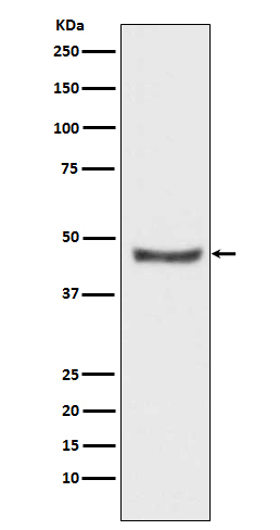 PHD2 Antibody in Western Blot (WB)